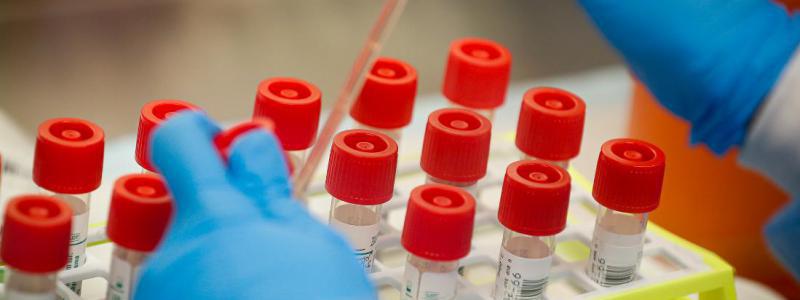 laborator coronavirus